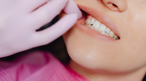 High-Demand Oral Care Products for Private Labeling