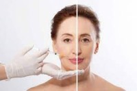 Best Dermal Filler Manufacturers for Private Label & Wholesale